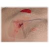 Hyfin Vent Chest Seal, Twin pack - Bild 5